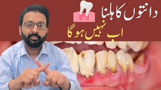 LOOSE TEETH Treatment Home Remedies [upl. by Lodi]