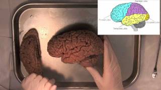 MIT Introduction to Neuroanatomy Series Part 1 [upl. by Agatha]