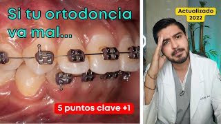 ¿Tu ortodoncia va mal 🔥 5 Puntos clave  Ortodoncia mal hecha  Dr Yamir Rivera [upl. by Ocko368]