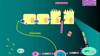 Enfermedad celiaca fisiopatología [upl. by Gide]