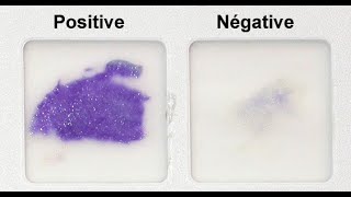 Oxidase Test Practical Tutorial [upl. by Kcuhc897]