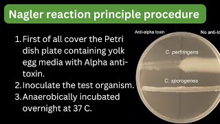 Clostridium perfringens Nagler reaction principle procedure lecithinase test labtech mltbyrahul [upl. by Leahcimaj]