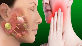 Salivary Gland Infection Causes And Treatment [upl. by Netnerb230]