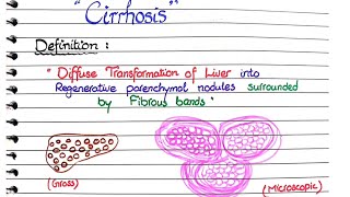 Cirrhosis of Liver  Pathology [upl. by Doran]