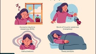 NARCOLEPSY… A CHRONIC DISEASE🤔 [upl. by Ahseer]