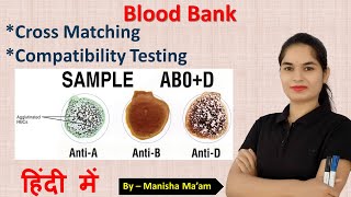 Cross Match Test in blood bank  Technique of cross matching  cross matching blood procedure [upl. by Curr]