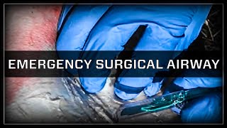 Emergency Surgical Airway  Cricothyroidotomy [upl. by Olwen76]