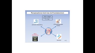 Therapieoptionen beim lowriskProstatakarzinom  Strahlentherapie Prof Hilke Vorwerk [upl. by Aridni]