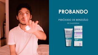 Probando PEROXIDO DE BENZOILO de Galderma FUNCIONA para el acné [upl. by Jasmin]