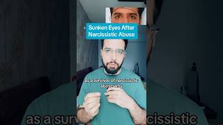 Sunken Eyes After Narcissistic Abuse narcissism [upl. by Itch]