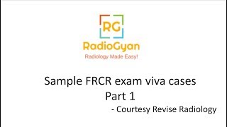 FRCR part 2B viva cases  RadioGyancom  Radiology Made Easy [upl. by Ramos721]