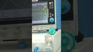 ventilator sound in ICUyoutubeshortsvlogs subscribe nursing nurse surgeryday 🛌🛌 [upl. by Nylaras]