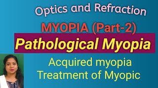 Myopia Part 2 Pathological myopia Acquired myopia Treatment of Myopia [upl. by Dardani651]