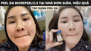 PEEL DA Biorepeelcl3 TCA 35 thế hệ mới tại nhà hiệu quả như đi Spa biorepeelcl3 [upl. by Erinna]