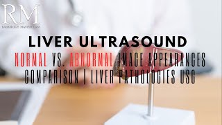 Liver Ultrasound Normal vs Abnormal Image Appearances Comparison  Liver Pathologies USG [upl. by Yror]