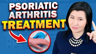 Psoriatic Arthritis NEW Treatment 2024 [upl. by Sandor220]