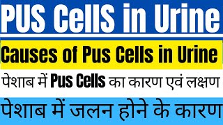 Pus Cells in Urine I Causes of Pus Cells in Urine I Pus Cells I Leukocytes in Urine I WBC in Urine I [upl. by Irollam]