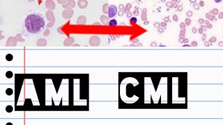 AML amp CML  Acute myeloid leukemia  Chronic myeloid leukemia  pathology slide identification [upl. by Naaman]