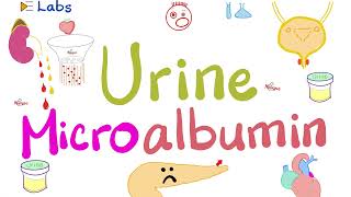 Microalbumin in the Urine Microalbuminuria  Diabetes Mellitus amp Kidney Disease  Nephrology Labs [upl. by Eirene405]