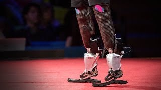 New bionics let us run climb and dance  Hugh Herr  TED [upl. by Roze571]