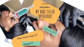 MY NON SURGICAL NOSE JOB EXPERIENCE FOR DARK SKIN [upl. by Deyes]