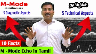 MMode எக்கோ பற்றிய 10 முக்கிய தகவல் தமிழில்  10 Unknown facts of M Mode Echocardiogram Echotest [upl. by Werbel]