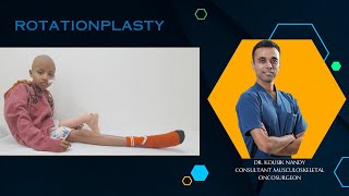 Rotationplasty  Osteosarcoma  Patient success story  Dr Kousik Nandy [upl. by Rainer]