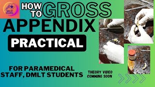 How To Gross A Appendix Specimen [upl. by Royall]