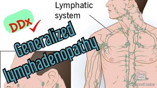 Approach to Diagnosing Generalized Lymphadenopathy [upl. by Ttayh]