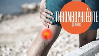 Comment traiter les thrombophlébites et caillots des veines par radiologie interventionnelle [upl. by Voss801]