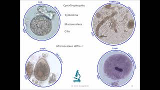 Balantidium coli Ciliate [upl. by Lemhar]