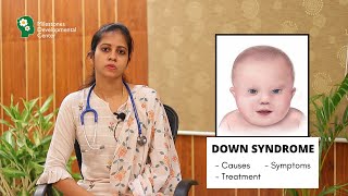 Down Syndrome  Explained by Dr Priyadharshini  Causes  Symptoms  Treatments  MDC Salem [upl. by Andromache]