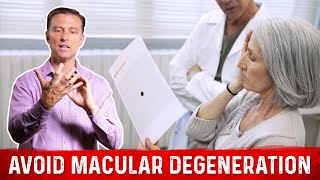 How to Prevent Macular Degeneration – Dr Berg [upl. by Eisse]