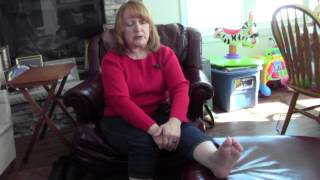 Flat Foot amp Bunion Surgery Testimonial [upl. by Eibbil513]