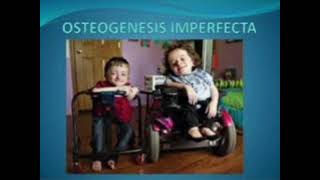 Osteogenesis imperfecta mrcpch Clinical [upl. by Naharba325]