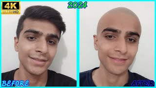 I Shaved My Head  My New Smooth​ Razor Summer​ Headshave​ 2024  Clippers To Razor Headshave [upl. by Giacomo]