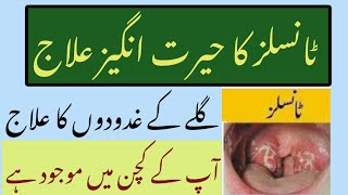 Tonsils ka desi ilaj Tonsils treatment at home home remedies Health and Waziaf Info [upl. by Shing]