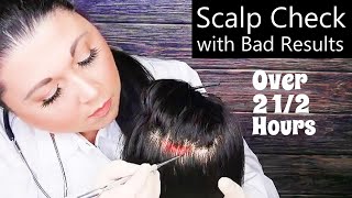 ASMR Scalp Check with Bad Results Compilation Scalp Treatment Whispering Medical Roleplay [upl. by Enila]