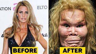 20 Celebrity Plastic Surgery Disasters [upl. by Nerred]