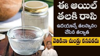 How to Reduce Dandruff Easily  Home Remedy to Scalp Reduce Itching  DrManthenas Health Tips [upl. by Meier]