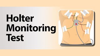 Holter Monitoring Test [upl. by Rabush713]