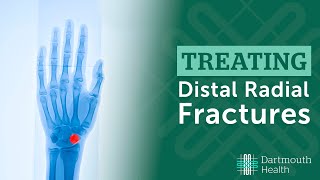 Treating Distal Radius Fractures at Dartmouth Health [upl. by Kaitlynn]