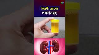 কিডনী রোগে যেসব লক্ষণ দেখা যায় । Symptomps of kidney disease [upl. by Tingey]