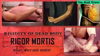 Rigor Mortis  Rigidity of the Dead Body  Early Changes  Thanatology  You Must Know [upl. by Arlynne]