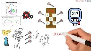 PhysicianDirected Physiologic Insulin Resensitization  Diabetics Choice [upl. by Maryanna908]