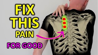 Fix Rhomboid Pain For Good Shoulder Blade Pain [upl. by Ssac753]