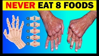 Arthritis Warning NEVER Eat These 8 Foods [upl. by Thin]