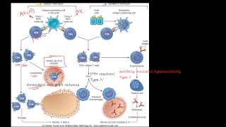 83P  Transplant rejection  Immunological basis and explanation MHC CD4 CD8 T cell [upl. by Nan]