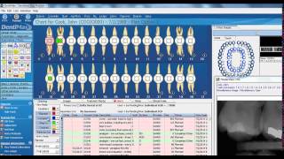 Clinical Charting  DentiMax Dental Software Features [upl. by Solegna398]