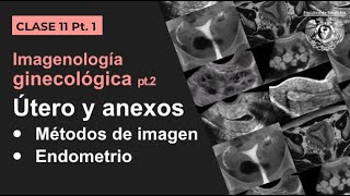 111  Imagen Ginecológica Métodos de estudio y patología endometrial [upl. by Enomrej]